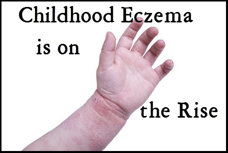 Skin_Disorders_Childhood_Eczema_is_on_the_rise_Eczemate