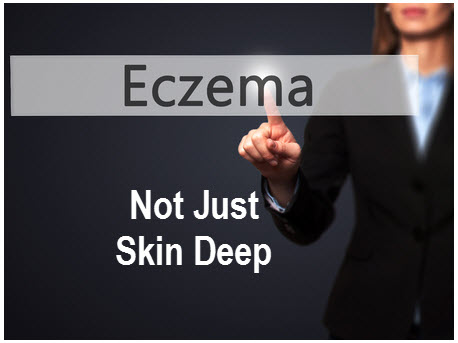 Eczema_Not_Just_Skin_Deep_EczeMate