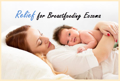 eczema_symptom_relief_find_relief_breastfeeding_eczema_eczemate